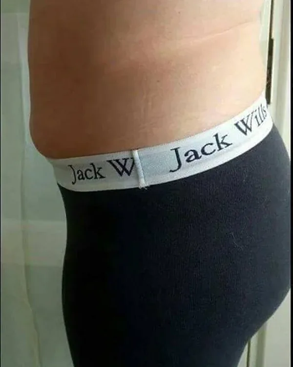 Side view of an abdomen after one skin-tightening session